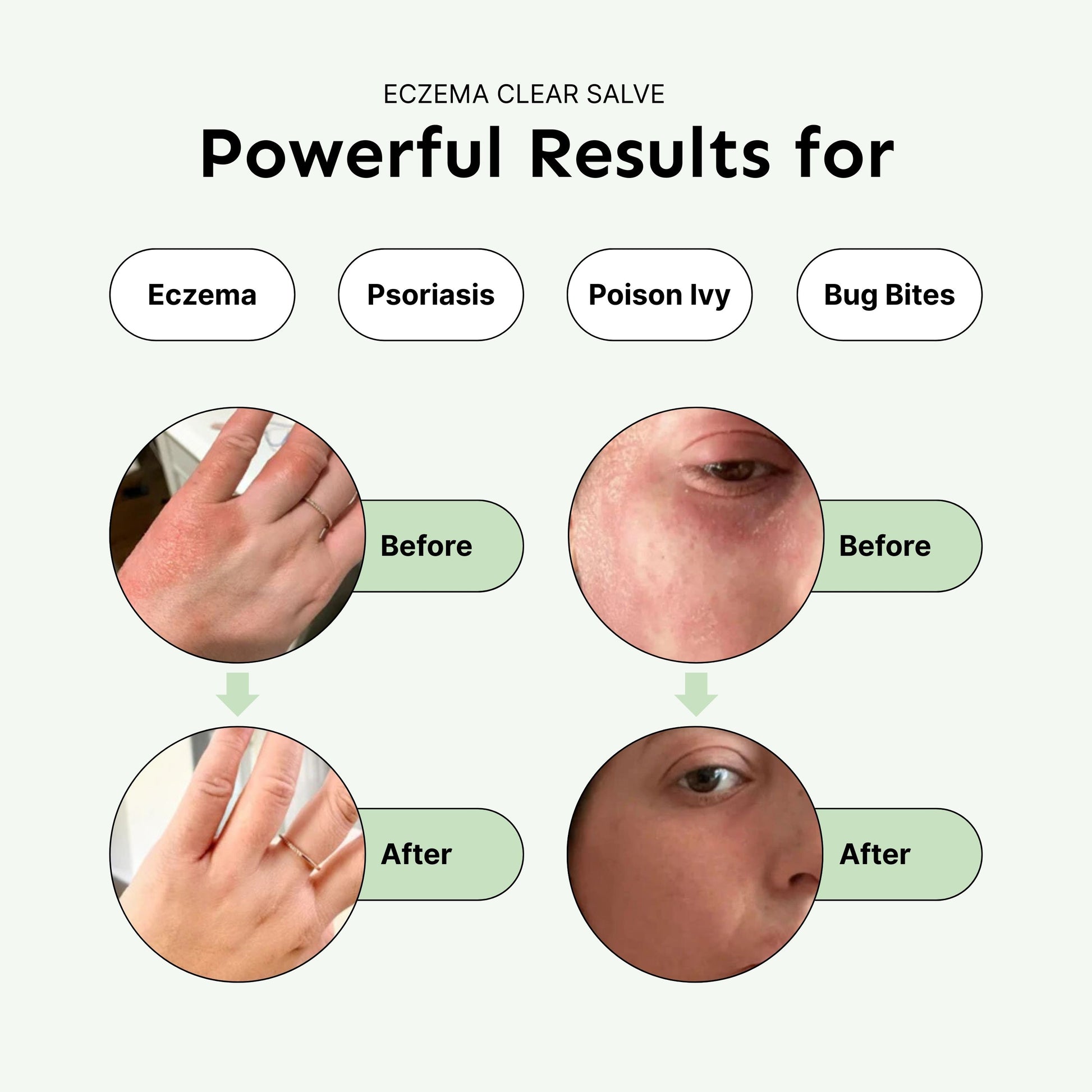Natural Relief Salves