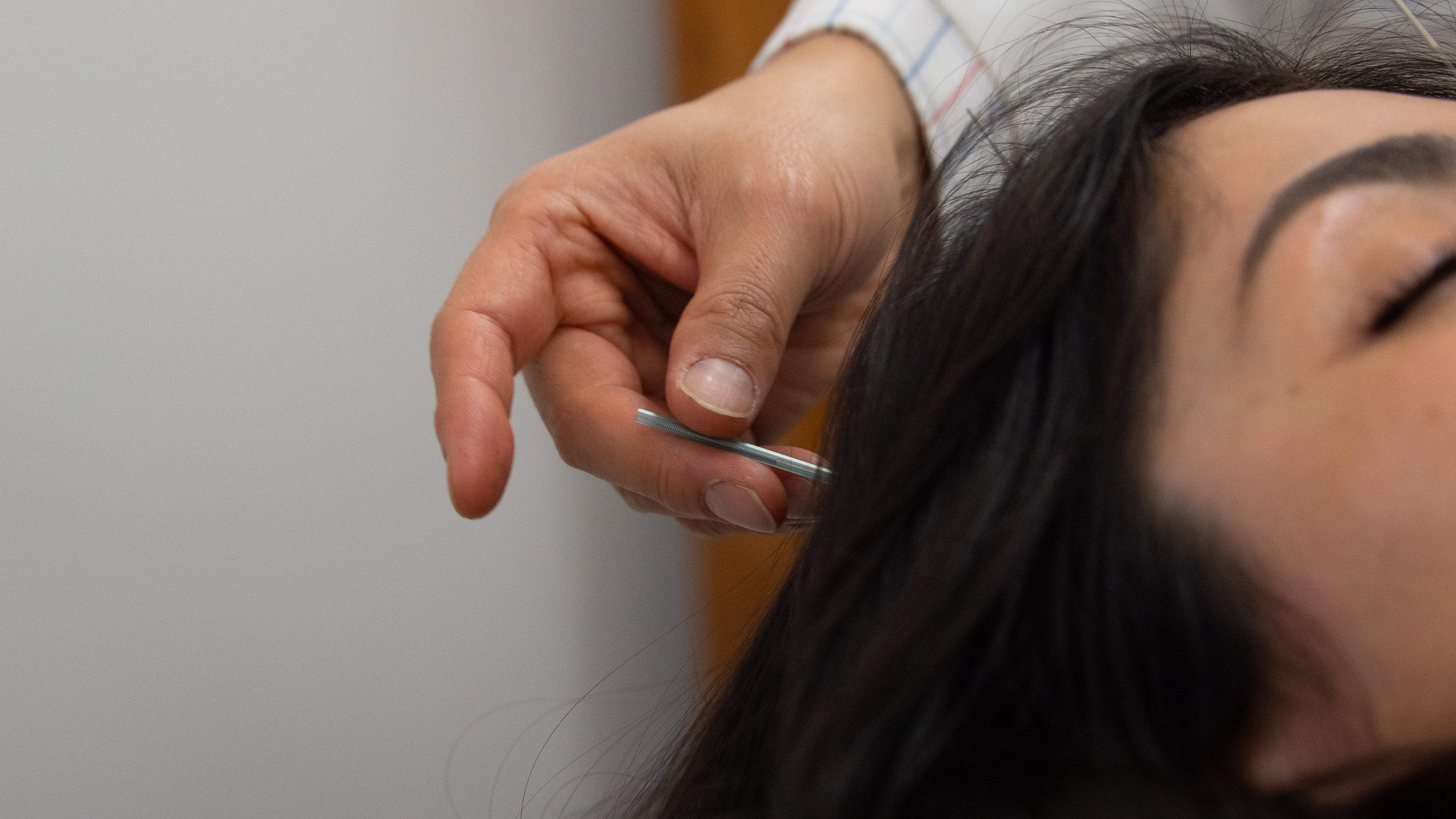 Electro-Acupuncture