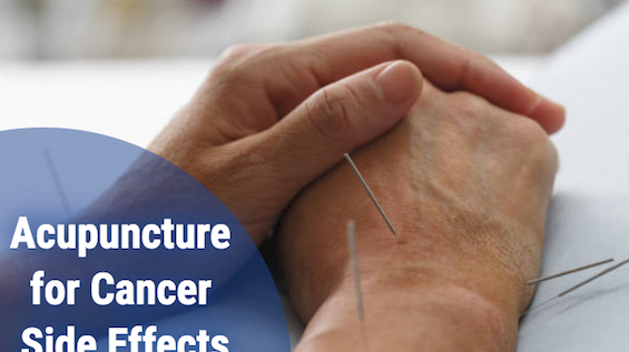 How Acupuncture Can Support You During Chemotherapy: My Personal Experience and Scientific Evidence