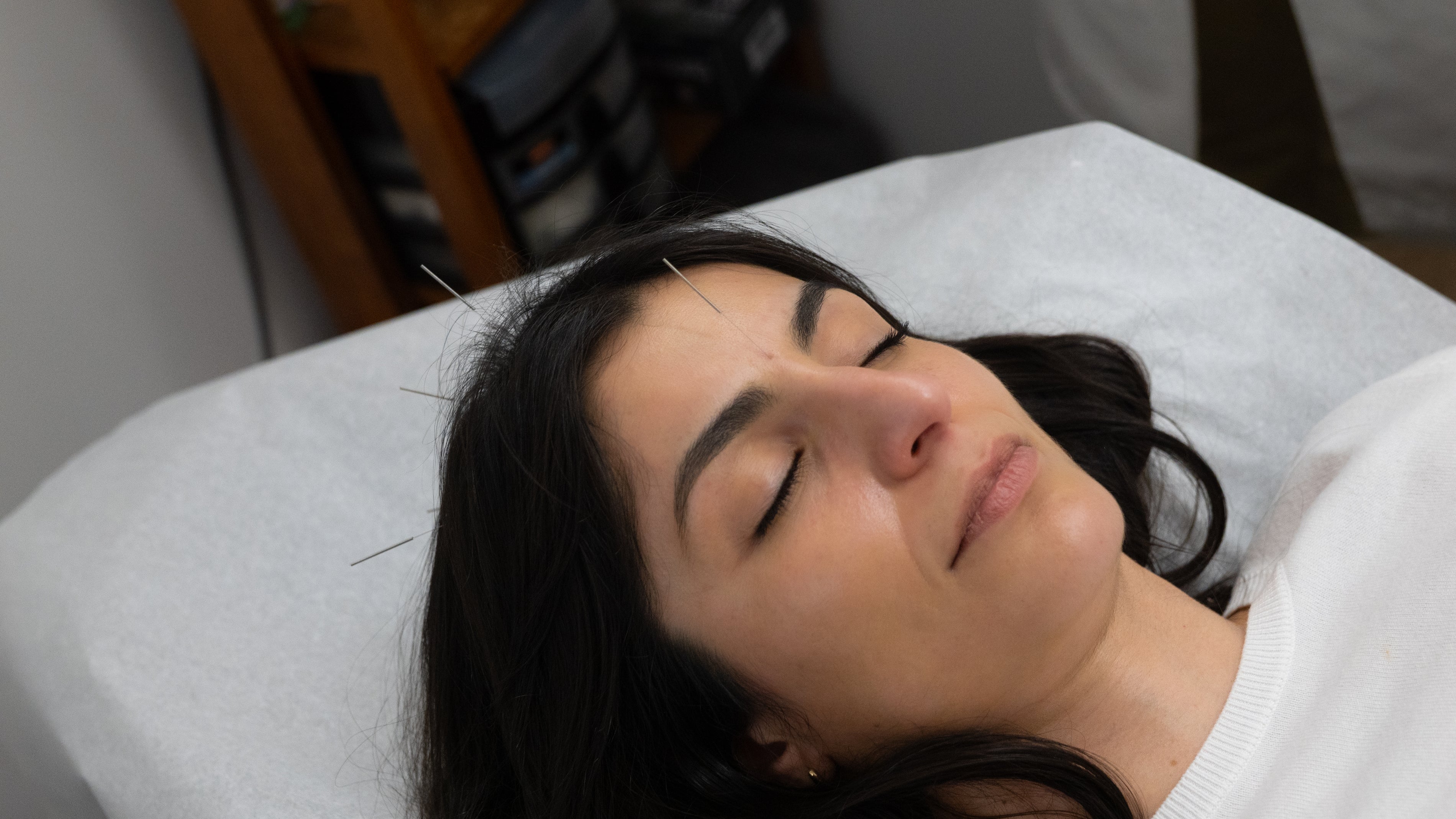 Traditional Acupuncture